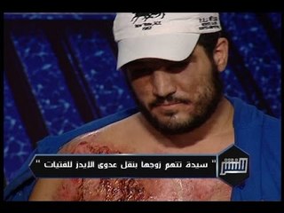 للنشر : مصاب بالإيدز ينتقم بنقل العدوى لفتياتٍ وشبانٍ