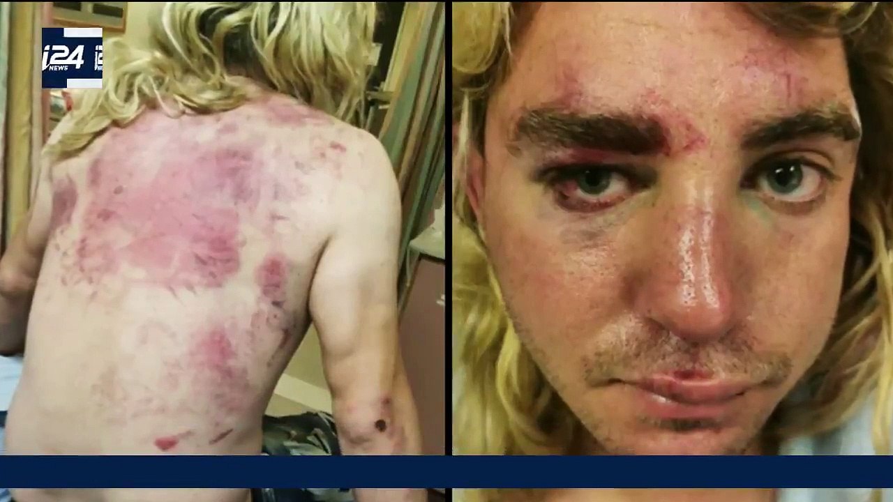 Jérusalem: Les images hyper violentes d'un jeune Israélien attaqué par des Palestiniens en pleine rue provoquent une vive émotion (attention vidéo très dure)