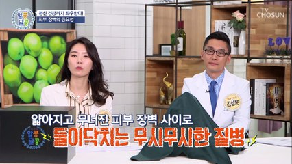 (충격) 피부 질환도 면역력과 관련이 있다!? TV CHOSUN 20210429 방송