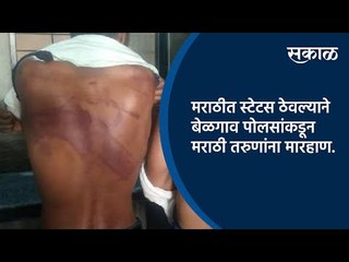 मराठीत स्टेटस ठेवल्याने बेळगाव पोलसांकडून मराठी तरुणांना मारहाण.| Belgaum | Sakal Media |