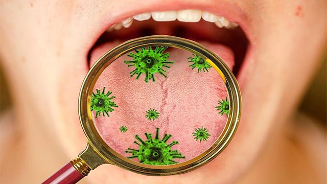 Corona Virus Patient की Tongue पर दिखे ये निशान तो जरूर कराएं Corona Test | Boldsky