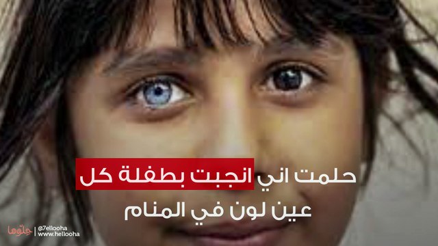 حلمت اني انجبت بطفلة كل عين لون في المنام