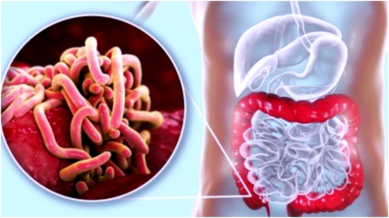 Why Does My Anus Itch? 7 Causes of Anal Itching video Dailymotion