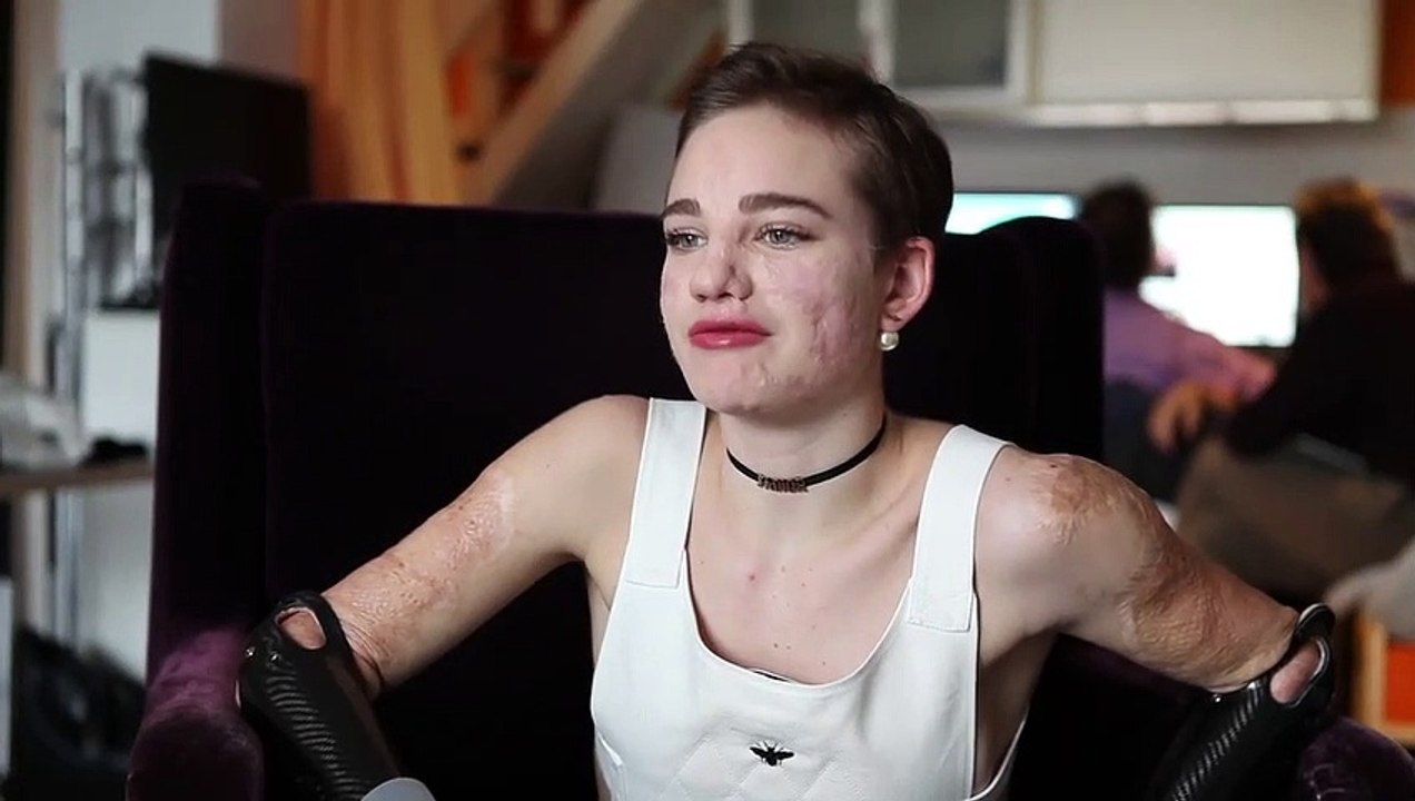 Bebe Vio su Rolling Stone: «Vaccinatevi! Salvatevi la vita» | Rolling Stone Italia