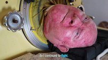 The Man in the Iron Lung