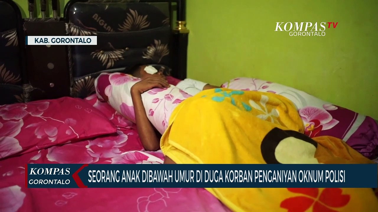 Seorang Anak Dibawah Umur Diduga Jadi Korban Penganiayaan Oknum Polisi