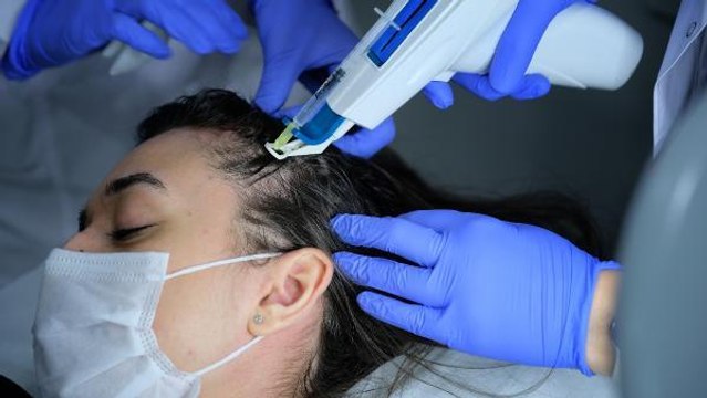 'KORONAVİRÜS HASTALARINDA SAÇ DÖKÜLMESİ GÖRÜLÜYOR'