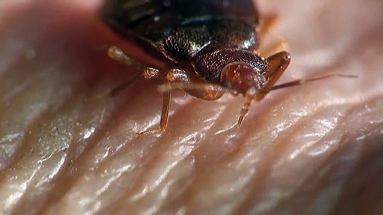 Bed Bugs Drinking Blood video Dailymotion