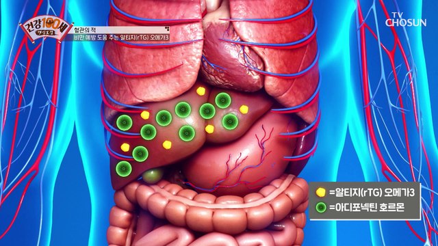 비만 예방하고 혈관 건강에 도움 되는 「알티지 오메가3」 TV CHOSUN 210503 방송