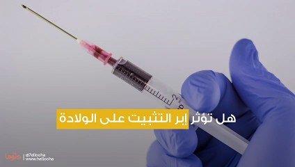 هل تؤثر إبر التثبيت على الولادة