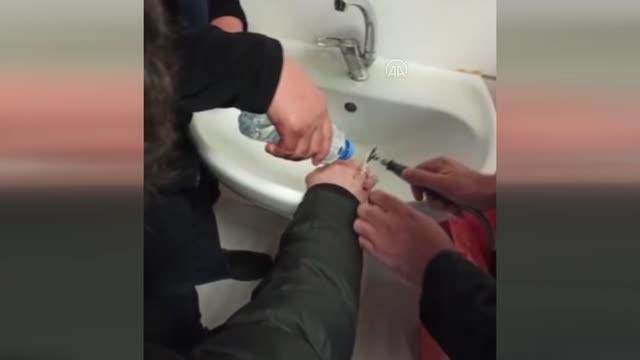 Parmağına sıkışan yüzüğü çıkaramayan kişinin imdadına itfaiye yetişti