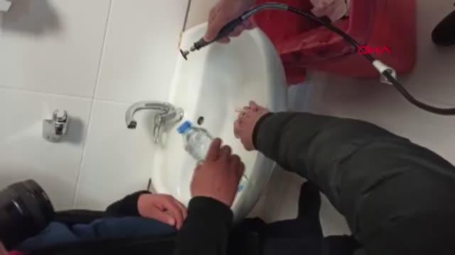 Son dakika haberleri... SİVAS PARMAĞINA SIKIŞAN YÜZÜĞÜ İTFAİYE ÇIKARDI