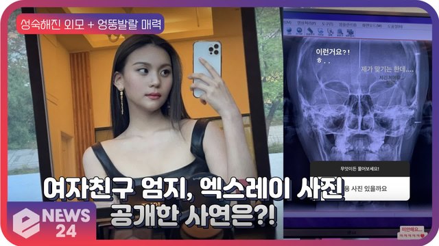 여자친구(GFRIEND) 엄지, ‘일코용 사진’으로 ‘엑스레이 사진’ 추천? ‘엉뚱 발랄 매력’