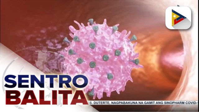 DOH, tiniyak na ligtas ang Sputnik V sa mga may edad 18 pataas; side effects ng Sputnik V, katulad din umano sa ibang bakuna