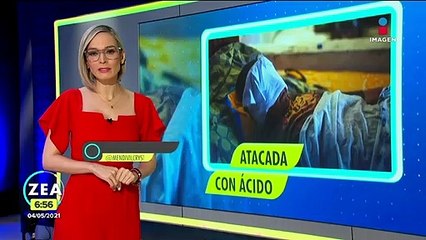 Mujer podría perder la vista tras ataque con ácido | Noticias con Francisco Zea