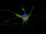 Scientists see path for the coronavirus to invade the brain | Moon TV News