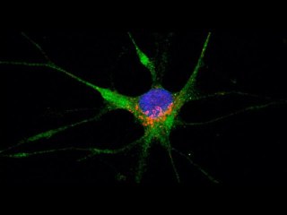 Scientists see path for the coronavirus to invade the brain | Moon TV News