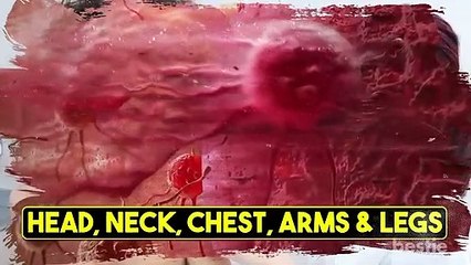 Warning Signs You May Have Skin Cancer_