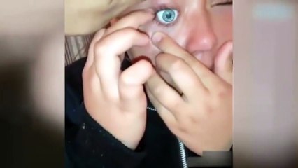 Oyuncak bebeğin gözünü kendi gözüne taktı!