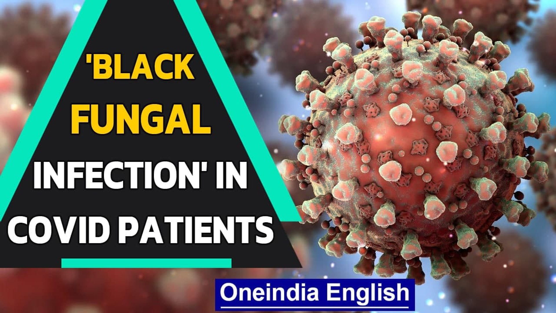Delhi Sir Ganga Ram Hospital Sees The Rise Of Black Fungal Infection In Covid 19 Patients Video Dailymotion