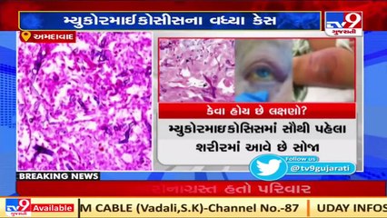 Amid Covid 19 crisis, Mucormycosis cases on the rise in Ahmedabad _ TV9News