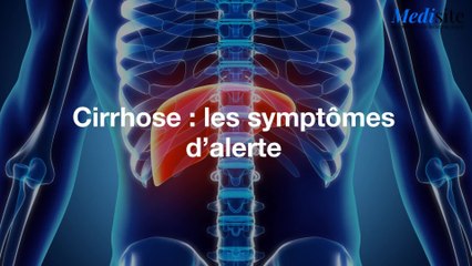 Cirrhose : les symptômes d’alerte