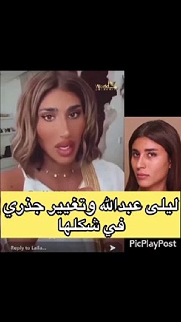 نغير ملامح ليلى عبد الله بالكامل بعد عمليات التجميل فيديو Dailymotion