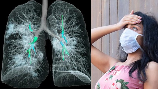 Corona Virus तीन दिन में कर रहा बड़ा हमला, LUNGS का हो रहा ये हाल | Boldsky