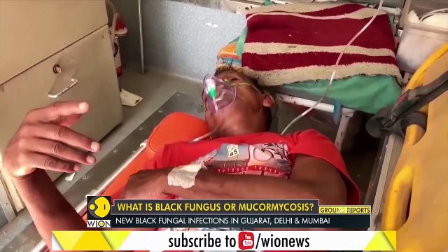 Black Fungus on rise in India _ COVID-19 infection _ What is black fungus _ Latest English News
