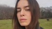 Kasia Smutniak con la vitiligine: 'Ho smesso di notarla'