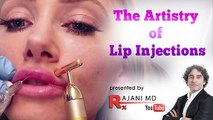Lip Filler Russian Tenting Technique Demonstrated - Lip Filler Before And After