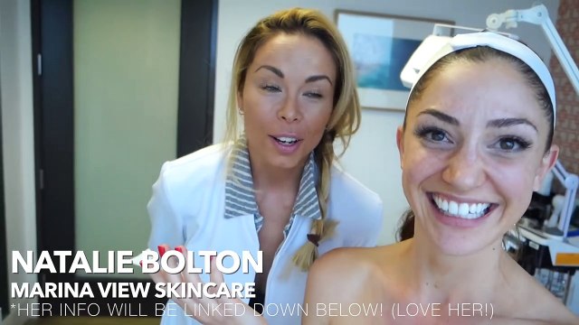 I Got A Chemical Peel! Perfect Peel Review, Daily Check In + Before/After!