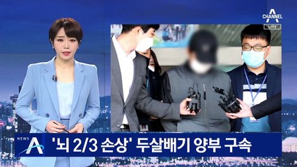 ‘뇌 2/3 손상’ 두 살배기 학대한 양부 구속…양모도 입건