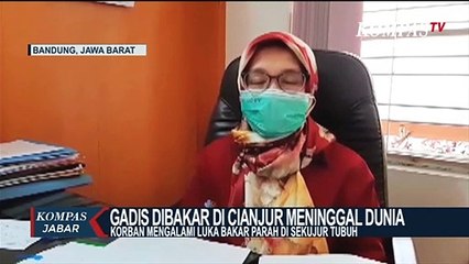 Dirawat Intensif, Gadis Dibakar di Cianjur Meninggal Dunia
