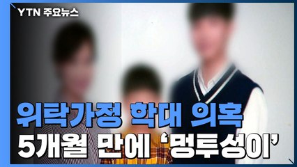 민간 위탁가정서 '멍투성이' 된 4살 아이...경찰 "직접 증거 없다" / YTN