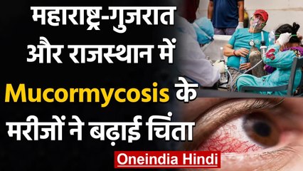 Maharashtra, Gujarat और Rajasthan में हजारों की तादाद में Mucormycosis के मरीज | वनइंडिया हिंदी