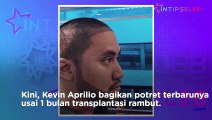 Penampilan Kevin Aprilio Setelah Transplantasi Rambut
