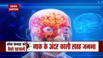 Combat Black Fungus:कोरोना संक्रमित मरीज पर Black Fungus का शिकार