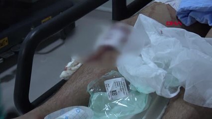 SAMSUN TABANCAYLA BAYRAM KUTLAYAN MAGANDA KENDİNİ VE ARKADAŞINI YARALADI