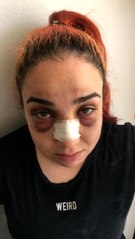 Telefonla konuştuğu için çalışanını darp etti