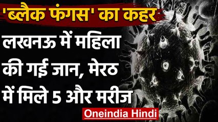 Lucknow में Corona से ठीक हो चुकी महिला की Black Fungus ने ले ली जान । वनइंडिया हिंदी