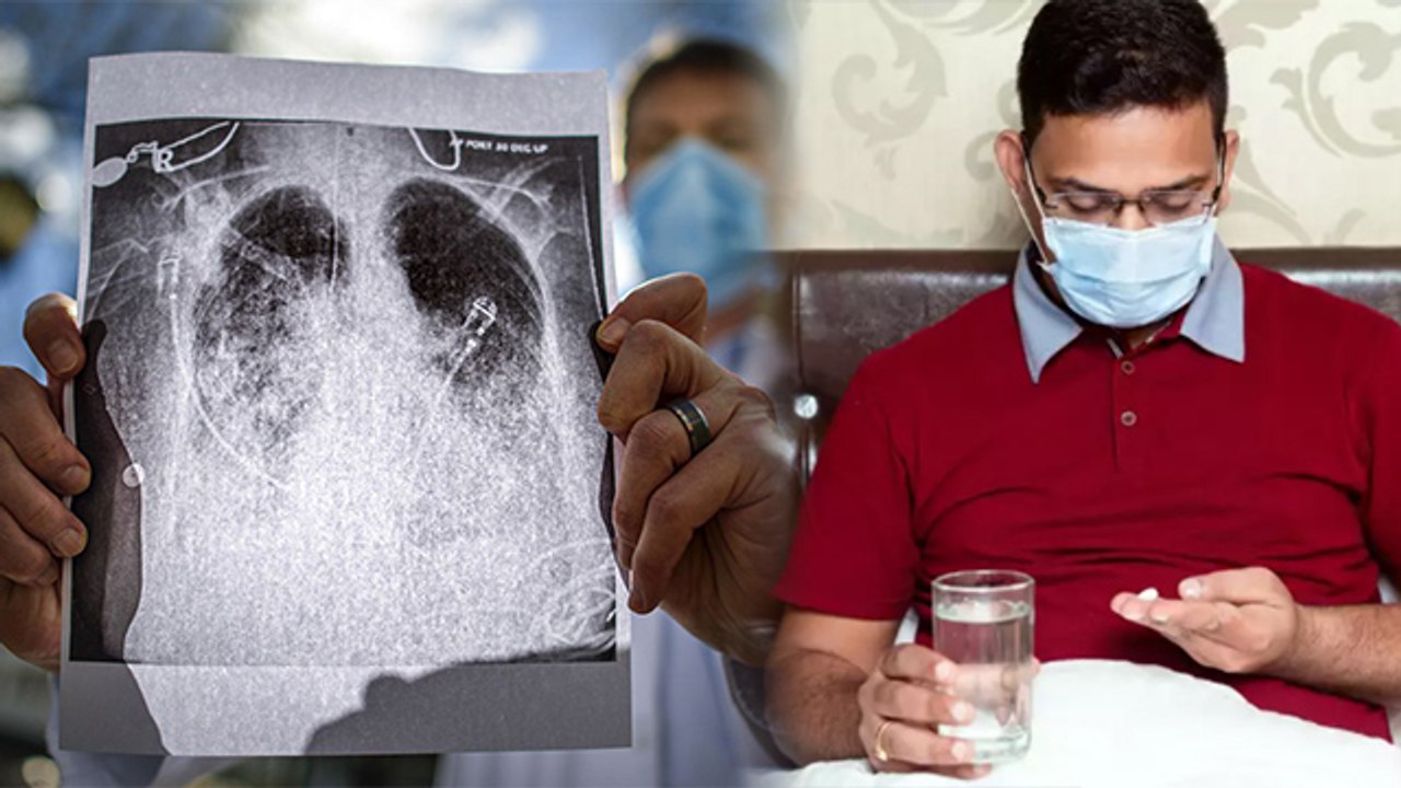 Corona Virus Patient को क्यों हो रहा Double Pneumonia, Symptoms जानकर करें बचाव | Boldsky