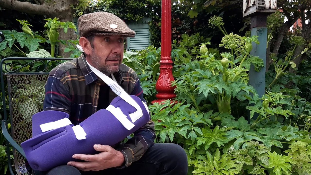 Firework victim recovering at home