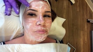 Skinpen: My Microneedling Experience