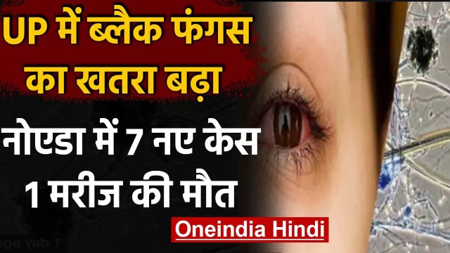 Black Fungus: UP में ब्लैक फंगस का खतरा, Noida में 7 नए मरीज, एक की मौत | वनइंडिया हिंदी