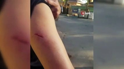 Eyüpsultan’da köpek dehşet saçtı