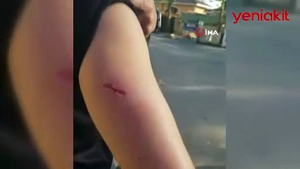 Köpek dehşetine uğrayan adam isyan etti