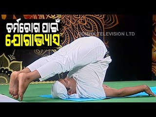 Roga Payin Yoga | Yoga For Skin Disease-Watch OTV Special Programme