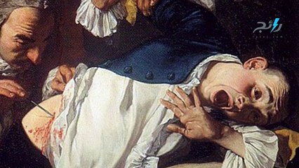 أوائل-أول من استخدم التخدير العام