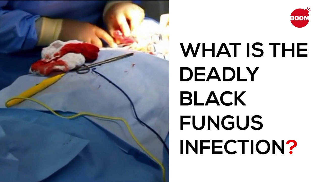 Symptoms of Black Fungus: Mucormycosis Explained | BOOM | What Is Black Fungus? | COVID-19 in India